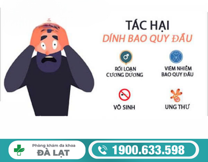 Hình ảnh minh họa